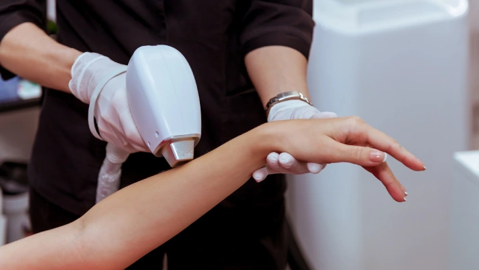 فرایند لیزر موهای زائد