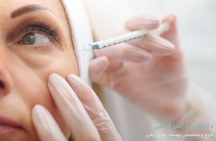 کاربردهای فیلر چشم چیست؟