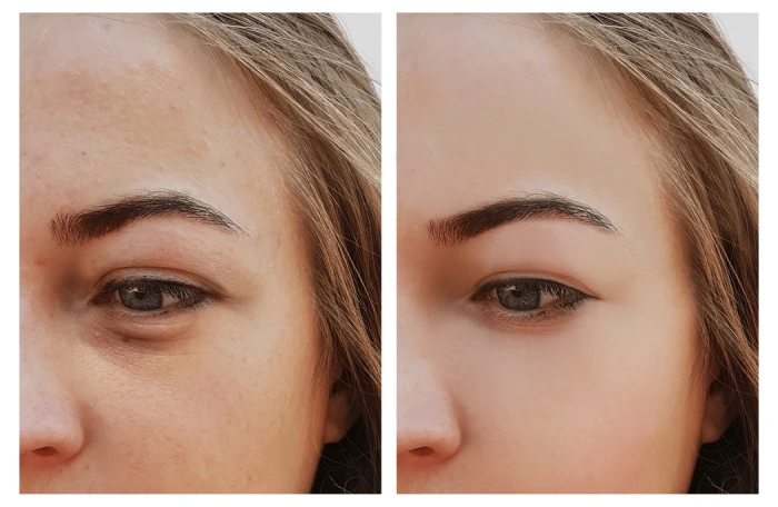 ماندگاری ژل زیر چشم چقدر است؟