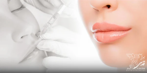 منظور از ترمیم ژل لب