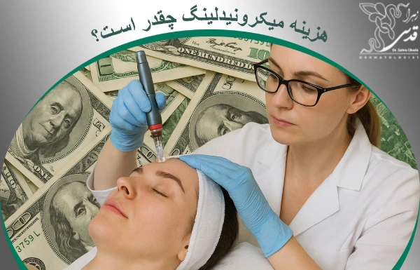 هزینه میکرونیدلینگ چقدر است؟
