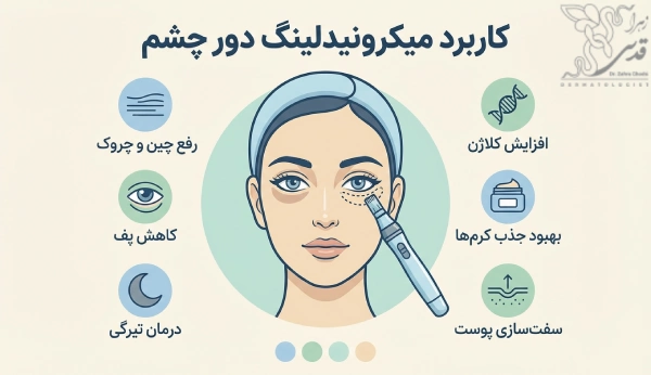 کاربرد میکرونیدلینگ دور چشم