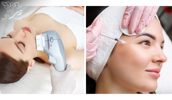 تفاوت پروفایلو و هایفو