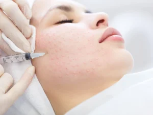 عوارض تزریق مزوژل