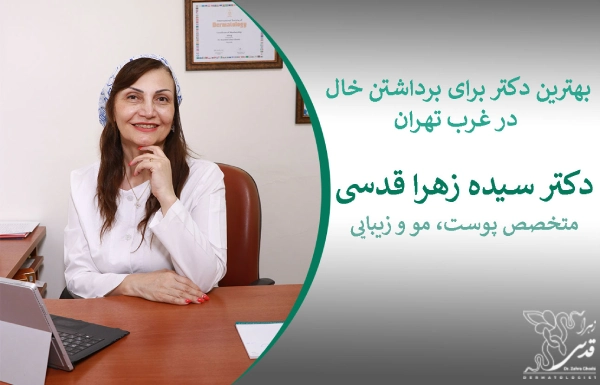 بهترین دکتر برای برداشتن خال در غرب تهران