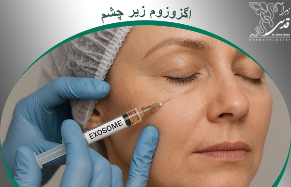 اگزوزوم زیر چشم چیست