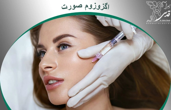 اگزوزوم صورت