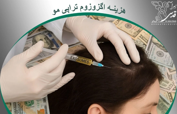 هزینه اگزوزوم تراپی مو چقدر است