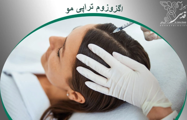 اگزوزوم تراپی مو